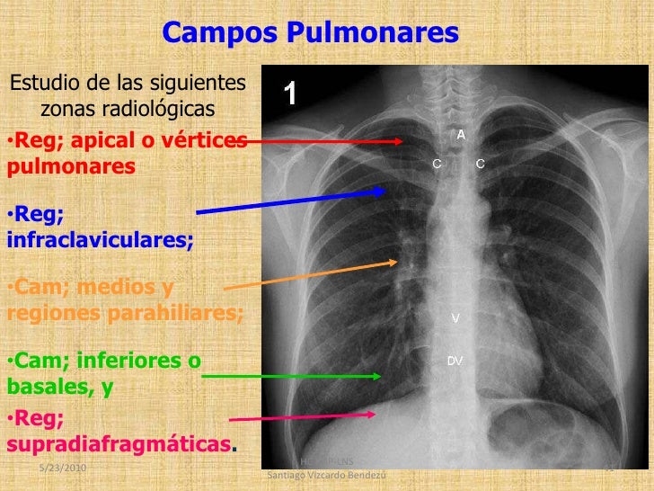 3RA CLASE USJB Rx Septimo Ciclo Pnp