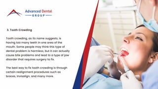 Problem With Too Many Teeth 5 Common Dental and Oral Diseases | PDF