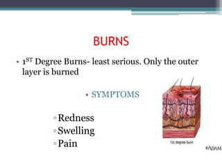 BURNS
• 1ST Degree Burns- least serious. Only the outer
  layer is burned

                  • SYMPTOMS

          ▫Redness
          ▫Swelling
          ▫Pain
 