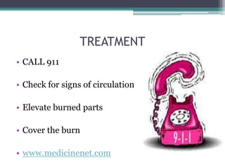 TREATMENT
• CALL 911

• Check for signs of circulation

• Elevate burned parts

• Cover the burn

• www.medicinenet.com
 