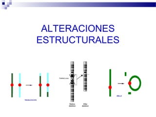 ALTERACIONES
ESTRUCTURALES
 