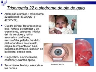 Trisonomia 22 o síndrome de ojo de gato
 Alteración cromoso.: cromosoma
22 adicional (47,XX+22 o
47,XY+22).
 Cuadro clínico: Retardo mental
leve, retraso psicomotor y del
crecimiento, coloboma inferior
del iris coroides y retina,
anomalías cardíacas,
microcefalia, paladar hendido,
piel redundante en el cuello,
orejas de implantación baja,
pulgares anormales, luxación de
la cadera, atresia anal.
 Diagnostico: amniocentesis,
cariotipo y examen óptico.
 Tratamiento: No hay, asesoría a
los padres.
 