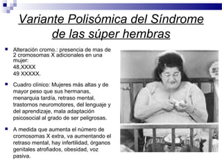 Variante Polisómica del Síndrome
de las súper hembras
 Alteración cromo.: presencia de mas de
2 cromosomas X adicionales en una
mujer:
48,XXXX
49 XXXXX.
 Cuadro clínico: Mujeres más altas y de
mayor peso que sus hermanas,
menarquia tardía, retraso mental,
trastornos neuromotores, del lenguaje y
del aprendizaje, mala adaptación
psicosocial al grado de ser peligrosas.
 A medida que aumenta el número de
cromosomas X extra, va aumentando el
retraso mental, hay infertilidad, órganos
genitales atrofiados, obesidad, voz
pasiva.
 
