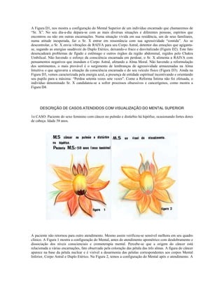 A Figura D1, nos mostra a configuração do Mental Superior de um indivíduo encarnado que chamaremos de 
“Sr. X”. No seu dia-a-dia depara-se com as mais diversas situações e diferentes pessoas, espíritos que 
encontrou ou não em outras encarnações. Numa situação vivida em sua residência, um de seus familiares, 
numa atitude inesperada, faz o Sr. X entrar em ressonância com sua agressividade “contida”. Ao se 
descontrolar, o Sr. X envia vibrações de RAIVA para seu Corpo Astral, detentor das emoções que agiganta-se, 
sugando as energias saudáveis do Duplo Etérico, deixando-o fraco e desvitalizado (Figura D2). Este fato 
desencadeará problemas de fígado e estômago e outros órgãos da região abdominal, regidos pelo Chakra 
Umbilical. Não havendo o esforço da consciência encarnada em perdoar, o Sr. X alimenta a RAIVA com 
pensamentos negativos que inundam o Corpo Astral, afetando a Alma Moral. Não havendo a reformulação 
dos sentimentos, o mais provável é o surgimento de lembranças de agressividade armazenadas na Alma 
Intuitiva o que agravaria a situação da consciência encarnada e do seu veículo físico (Figura D3). Ainda na 
Figura D3, vemos caracterizada pela energia azul, a presença de entidade espiritual incentivando e orientando 
seu pupilo para a máxima: “Perdoa setenta vezes sete vezes”. Como a Reforma Íntima não foi efetuada, o 
indivíduo denominado Sr. X candidatou-se a sofrer processos obsessivos e cancerígenos, como mostra a 
Figura D4. 
DESCRIÇÃO DE CASOS ATENDIDOS COM VISUALIZAÇÃO DO MENTAL SUPERIOR 
1o CASO: Paciente do sexo feminino com câncer no pulmão e distúrbio há hipófise, ocasionando fortes dores 
de cabeça. Idade 58 anos. 
A paciente não retornou para outro atendimento. Mesmo assim verificou-se sensível melhora em seu quadro 
clínico. A Figura 1 mostra a configuração do Mental, antes do atendimento apométrico com desdobramento e 
dissociação dos níveis conscienciais e cromoterapia mental. Percebe-se que a origem do câncer está 
relacionada a várias encarnações, fato observado pela coloração das pétala das três almas. A figura do câncer 
aparece na base da pétala nuclear e é visível a desarmonia das pétalas correspondentes aos corpos Mental 
Inferior, Corpo Astral e Duplo Etérico. Na Figura 2, temos a configuração do Mental após o atendimento. A 
 