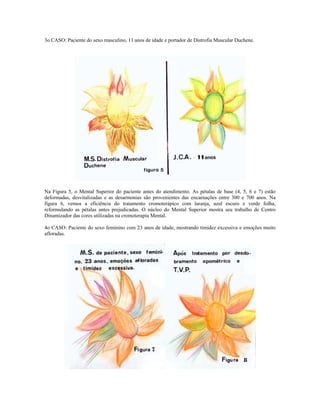 3o CASO: Paciente do sexo masculino, 11 anos de idade e portador de Distrofia Muscular Duchene. 
Na Figura 5, o Mental Superior do paciente antes do atendimento. As pétalas de base (4, 5, 6 e 7) estão 
deformadas, desvitalizadas e as desarmonias são provenientes das encarnações entre 300 e 700 anos. Na 
figura 6, vemos a eficiência do tratamento cromoterápico com laranja, azul escuro e verde folha, 
reformulando as pétalas antes prejudicadas. O núcleo do Mental Superior mostra seu trabalho de Centro 
Dinamizador das cores utilizadas na cromoterapia Mental. 
4o CASO: Paciente do sexo feminino com 23 anos de idade, mostrando timidez excessiva e emoções muito 
afloradas. 
 