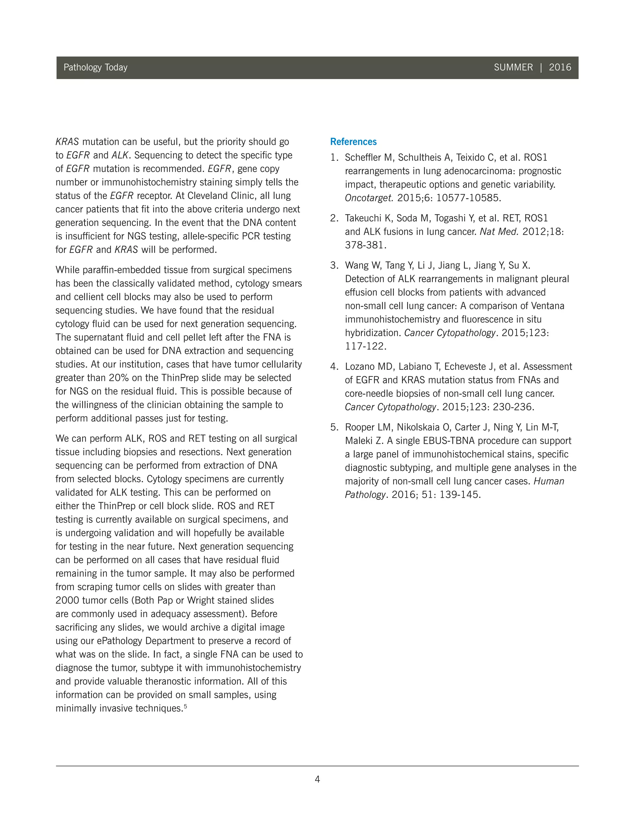 4
Pathology Today SUMMER | 2016
KRAS mutation can be useful, but the priority should go
to EGFR and ALK. Sequencing to detect the specific type
of EGFR mutation is recommended. EGFR, gene copy
number or immunohistochemistry staining simply tells the
status of the EGFR receptor. At Cleveland Clinic, all lung
cancer patients that fit into the above criteria undergo next
generation sequencing. In the event that the DNA content
is insufficient for NGS testing, allele-specific PCR testing
for EGFR and KRAS will be performed.
While paraffin-embedded tissue from surgical specimens
has been the classically validated method, cytology smears
and cellient cell blocks may also be used to perform
sequencing studies. We have found that the residual
cytology fluid can be used for next generation sequencing.
The supernatant fluid and cell pellet left after the FNA is
obtained can be used for DNA extraction and sequencing
studies. At our institution, cases that have tumor cellularity
greater than 20% on the ThinPrep slide may be selected
for NGS on the residual fluid. This is possible because of
the willingness of the clinician obtaining the sample to
perform additional passes just for testing.
We can perform ALK, ROS and RET testing on all surgical
tissue including biopsies and resections. Next generation
sequencing can be performed from extraction of DNA
from selected blocks. Cytology specimens are currently
validated for ALK testing. This can be performed on
either the ThinPrep or cell block slide. ROS and RET
testing is currently available on surgical specimens, and
is undergoing validation and will hopefully be available
for testing in the near future. Next generation sequencing
can be performed on all cases that have residual fluid
remaining in the tumor sample. It may also be performed
from scraping tumor cells on slides with greater than
2000 tumor cells (Both Pap or Wright stained slides
are commonly used in adequacy assessment). Before
sacrificing any slides, we would archive a digital image
using our ePathology Department to preserve a record of
what was on the slide. In fact, a single FNA can be used to
diagnose the tumor, subtype it with immunohistochemistry
and provide valuable theranostic information. All of this
information can be provided on small samples, using
minimally invasive techniques.5
References
1. 	Scheffler M, Schultheis A, Teixido C, et al. ROS1
rearrangements in lung adenocarcinoma: prognostic
impact, therapeutic options and genetic variability.
Oncotarget. 2015;6: 10577-10585.
2. 	Takeuchi K, Soda M, Togashi Y, et al. RET, ROS1
and ALK fusions in lung cancer. Nat Med. 2012;18:
378-381.
3. 	Wang W, Tang Y, Li J, Jiang L, Jiang Y, Su X.
Detection of ALK rearrangements in malignant pleural
effusion cell blocks from patients with advanced
non-small cell lung cancer: A comparison of Ventana
immunohistochemistry and fluorescence in situ
hybridization. Cancer Cytopathology. 2015;123:
117-122.
4. 	Lozano MD, Labiano T, Echeveste J, et al. Assessment
of EGFR and KRAS mutation status from FNAs and
core-needle biopsies of non-small cell lung cancer.
Cancer Cytopathology. 2015;123: 230-236.
5. 	Rooper LM, Nikolskaia O, Carter J, Ning Y, Lin M-T,
Maleki Z. A single EBUS-TBNA procedure can support
a large panel of immunohistochemical stains, specific
diagnostic subtyping, and multiple gene analyses in the
majority of non-small cell lung cancer cases. Human
Pathology. 2016; 51: 139-145.
 
