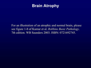 Brain Atrophy
For an illustration of an atrophic and normal brain, please
see figure 1-8 of Kumar et al. Robbins Basic Pathology.
7th edition. WB Saunders 2003. ISBN: 0721692745.
 