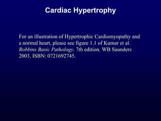 Cardiac Hypertrophy
For an illustration of Hypertrophic Cardiomyopathy and
a normal heart, please see figure 1.1 of Kumar et al.
Robbins Basic Pathology. 7th edition. WB Saunders
2003. ISBN: 0721692745.
 