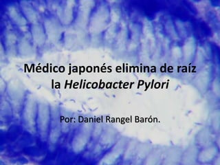 Médico japonés elimina de raíz
la Helicobacter Pylori
Por: Daniel Rangel Barón.
 