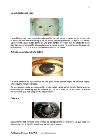 Publicación Cortesía de la Web: www.efemerides.ec
13
La ambliopía u ojo vago
La ambliopía u ojo vago consiste en la pérdida parcial, mayor o menor según el caso, de
la visión en uno o en los dos ojos de un niño/a, que no puede ser corregida con lentes.
Este defecto visual puede conllevar una gran pérdida de visión del ojo afectado, dado
que éste no se desarrolla adecuadamente y, poco a poco, va dejando de trabajar, de
estimularse, con lo que acaba perdiendo capacidad de visión.
Aniridia (ausencia o atrofia del iris
La parte externa del ojo anirídico es una gran pupila central negra, en muchos casos,
una pequeña franja coloreada.
Es un trastorno ocular en la que están involucradas varias partes del ojo. Generalmente
es bilateral (en ambos ojos) e incompleta, ya que en la mayoría de los casos, existe un
iris incipiente que no ha llegado ha desarrollarse.
Catarata
Esta enfermedad consiste en la pérdida de transparencia del cristalino. Lo que ocasiona
alteraciones en la función visual en mayor o menor grado.
 