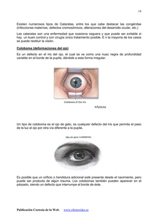 Publicación Cortesía de la Web: www.efemerides.ec
14
Existen numerosos tipos de Cataratas, entre los que cabe destacar las congénitas
(infecciones maternas, defectos cromosómicos, alteraciones del desarrollo ocular, etc.)
Las cataratas son una enfermedad que ocasiona ceguera y que puede ser evitable si
hay un buen control y con cirugía único tratamiento posible. E n la mayoría de los casos
se puede restituir la visión.
Coloboma (deformaciones del ojo)
Es un defecto en el iris del ojo, el cual se ve como una nuez negra de profundidad
variable en el borde de la pupila, dándole a esta forma irregular.
Un tipo de coloboma es el ojo de gato, es cualquier defecto del iris que permita el paso
de la luz al ojo por otra vía diferente a la pupila.
Es posible que un orificio o hendidura adicional esté presente desde el nacimiento, pero
puede ser producto de algún trauma. Los colobomas también pueden aparecer en el
párpado, siendo un defecto que interrumpe el borde de éste.
 