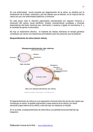 Publicación Cortesía de la Web: www.efemerides.ec
17
Es una enfermedad visual causada por degeneración de la retina, se clasifica por la
localización de la lesión, extensión y por las células que se afectan, en la mayoría de los
casos son por una enfermedad sistémica o síndrome.
En este grupo está la retinosis pigmentaria caracterizada por ceguera nocturna y
retracción del campo visual periférico. Existen características complejas y diversas
dependiendo del factor herencia sea dominante o recesiva y ligada al cromosoma X y
la variedad de genes involucrados.
No hay un tratamiento efectivo, el implante de células retinianas en terapia genética
constituyen por ahora una esperanza prometedora para las personas que la padecen.
Desprendimiento de retina (lesión retinal:
El desprendimiento de retina es una separación anormal entre dos de las dos capas que
constituyen la retina: el epitelio pigmentario (capa externa de la retina) y la retina
sensorial (capa interna de la retina), entre las que se interpone un líquido.
Si no se trata, el desprendimiento de retina lleva a la pérdida funcional total del ojo
(ceguera).
 