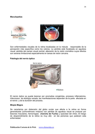 Publicación Cortesía de la Web: www.efemerides.ec
18
Maculopatías
Son enfermedades visuales de la retina localizadas en la mácula responsable de la
percepción más específica como los colores. La pérdida está focalizada en agudeza
visual, pérdida del campo visual central, alteración de la visión cromática cuyos efectos
son severas limitaciones especialmente en tareas de visión cercana.
Patología del nervio óptico
El nervio óptico se puede lesionar por anomalías congénitas, procesos inflamatorios,
infecciosos de etiología variada, las manifestaciones dependen de la parte afectada en
el nervio y de la duración del proceso.
Miopía Magna
Se caracteriza por distensión del globo ocular que afecta a la retina en forma
generalizada (coriorretinosis miópica) con pérdida de agudeza visual se produce por
lesiones maculares, hemorragias (mancha de Fuchs) y opacidad del vítreo. El riesgo
de desprendimiento de la retina es muy alto en las personas que padecen esta
enfermedad.
 
