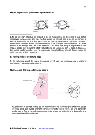 Publicación Cortesía de la Web: www.efemerides.ec
19
Miopía degenerativa (pérdida de agudeza visual
Este es un error refractivo en el cual el ojo es más grande de lo normal o sus partes
refractivas componentes son más fuertes que el ojo normal. Los rayos de luz tienden a
enfocarse enfrente de la fóvea. Las cosas se ven claras de cerca y de lejos borrosas,
estos niños prefieren hacer trabajos de cerca y no exploran sus alrededores. Su error
refractivo se corrige con una lente cóncava. Los niños con miopía degenerativa son
miopes desde muy temprana edad y el problema se acrecienta con el paso de los años.
Las lentes pueden ayudar, pero no corrigen su visión hasta ser normal. Corren riesgo de
sufrir desprendimiento de retina.
La retinopatía del prematuro (rop)
Es la patología visual de mayor incidencia en el país, se relaciona con el oxigeno
administrado a los niños prematuros.
Queratocono (Córnea en forma de cono):
Queratocono o córnea cónica es un desorden del ojo humano que raramente causa
ceguera pero que puede interferir significativamente con la visión. Es una condición
en la cual la forma normal redondeada de la cornea se distorsiona y desarrolla una
prominencia en forma de cono.
 
