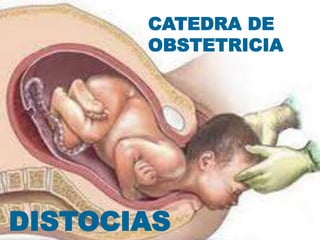 Dra. MONICA ALONSO
DISTOCIAS
CATEDRA DE
OBSTETRICIA
DISTOCIAS
 