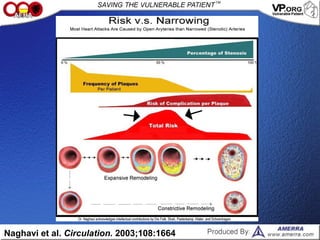 Naghavi et al. Circulation. 2003;108:1664
 