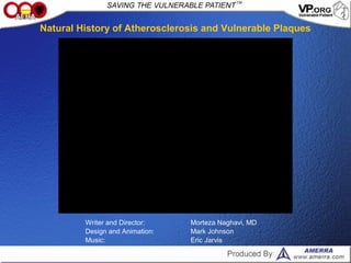 Writer and Director: Morteza Naghavi, MD
Design and Animation: Mark Johnson
Music: Eric Jarvis
Natural History of Atherosclerosis and Vulnerable Plaques
 