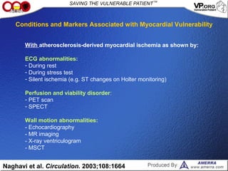 With atherosclerosis-derived myocardial ischemia as shown by:
ECG abnormalities:
- During rest
- During stress test
- Silent ischemia (e.g. ST changes on Holter monitoring)
Perfusion and viability disorder:
- PET scan
- SPECT
Wall motion abnormalities:
- Echocardiography
- MR imaging
- X-ray ventriculogram
- MSCT
Naghavi et al. Circulation. 2003;108:1664
Conditions and Markers Associated with Myocardial Vulnerability
 
