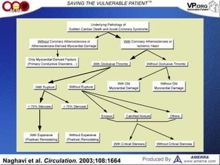 Naghavi et al. Circulation. 2003;108:1664
 