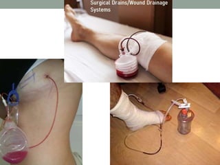 Drains & tubes used in surgery.pptx