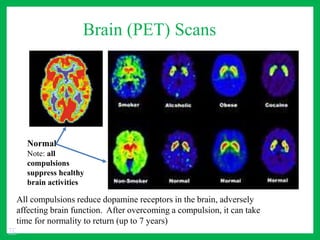 Brain (PET) Scans
Normal
Note: all
compulsions
suppress healthy
brain activities
All compulsions reduce dopamine receptors in the brain, adversely
affecting brain function. After overcoming a compulsion, it can take
time for normality to return (up to 7 years)
TC
 