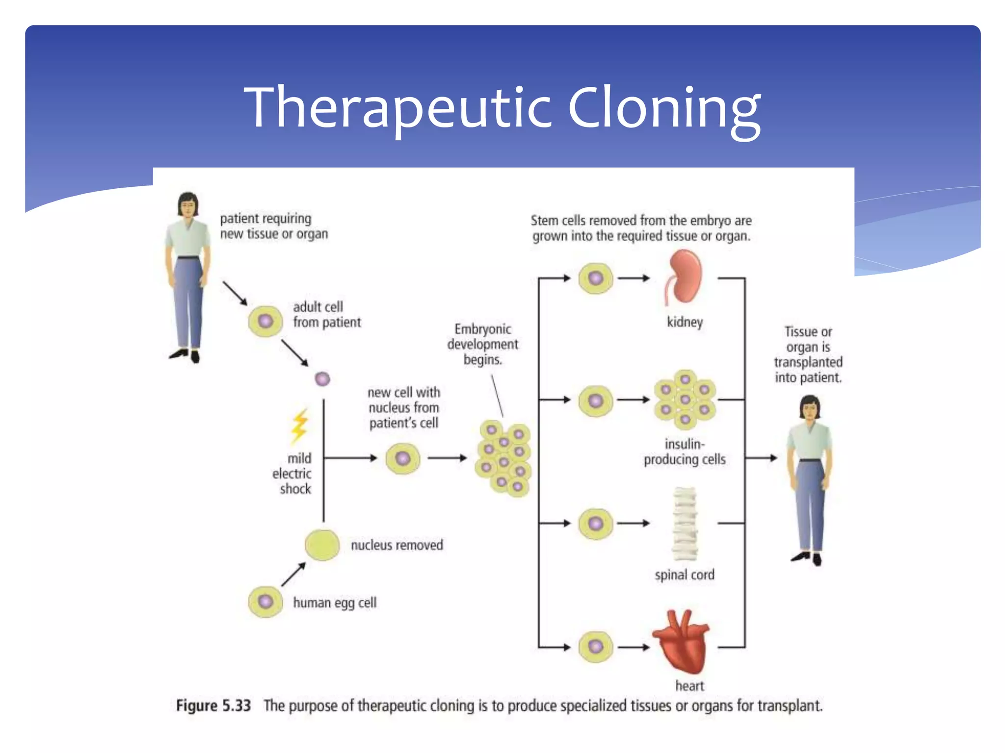 Therapeutic Cloning 
