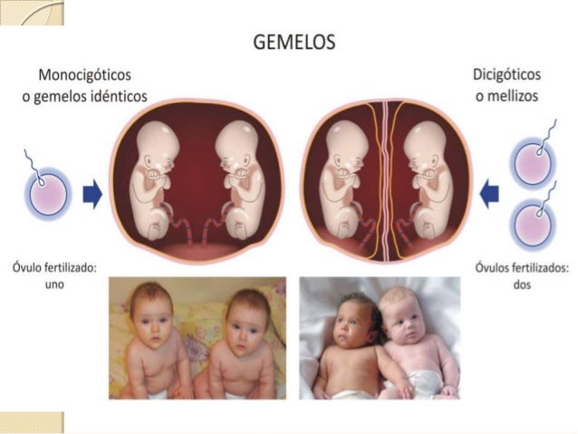 embarazo gemelar
