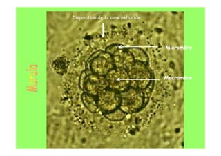 Disparition de la zone pellucide
Macromère
Micromère
 
