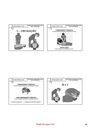 EMERGÊNCIAS CARDIOVASCULARES                                     EMERGÊNCIAS CARDIOVASCULARES
   SUPORTE BÁSICO À VIDA                  PARA A ENFERMAGEM            SUPORTE BÁSICO À VIDA                PARA A ENFERMAGEM




          C - CIRCULAÇÃO                                                      COMPRESSÃO TORÁCICA
                                                                        Aumenta a Perfusão de Pressão Coronariana (21 mmHg)




                                                                                       VENTILAÇÃO
                                                                             Diminui eficiência da Compressão Torácica




                                  EMERGÊNCIAS CARDIOVASCULARES                                     EMERGÊNCIAS CARDIOVASCULARES
   SUPORTE BÁSICO À VIDA                  PARA A ENFERMAGEM            SUPORTE BÁSICO À VIDA                PARA A ENFERMAGEM




           COMPRESSÃO TORÁCICA
   Aumenta a pressão intratorácica = esvaziamento ventricular
                                                                                           30 x 2




         DESCOMPRESSÃO TORÁCICA
     Diminui a pressão intratorácica = enchimento ventricular


RETORNO INCOMPLETO =         PRESSÃO DE PERFUSÃO CEREBRAL




                                                        BlogEnfermagem.com                                                        19
 
