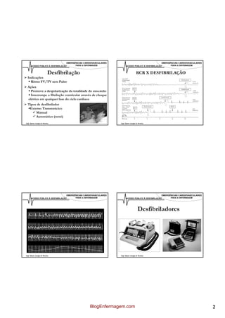 EMERGÊNCIAS CARDIOVASCULARES                                      EMERGÊNCIAS CARDIOVASCULARES
      ACESSO PÚBLICO À DESFIBRILAÇÃO     PARA A ENFERMAGEM              ACESSO PÚBLICO À DESFIBRILAÇÃO     PARA A ENFERMAGEM



                          Desfibrilação                                             RCR X DESFIBRILAÇÃO
  Indicações
    Ritmo FV/TV sem Pulso
  Ações
    Promove a despolarização da totalidade do miocárdio
    Interrompe a fibrilação ventricular através de choque
  elétrico em qualquer fase do ciclo cardíaco
  Tipos de desfibrilador
   Externo Transtorácico
       Manual
       Automático (semi)
Enf. Álamo Araújo B. Pereira                                      Enf. Álamo Araújo B. Pereira




                                   EMERGÊNCIAS CARDIOVASCULARES                                      EMERGÊNCIAS CARDIOVASCULARES
      ACESSO PÚBLICO À DESFIBRILAÇÃO     PARA A ENFERMAGEM              ACESSO PÚBLICO À DESFIBRILAÇÃO     PARA A ENFERMAGEM




                                                                                      Desfibriladores




Enf. Álamo Araújo B. Pereira                                      Enf. Álamo Araújo B. Pereira




                                                    BlogEnfermagem.com                                                              2
 