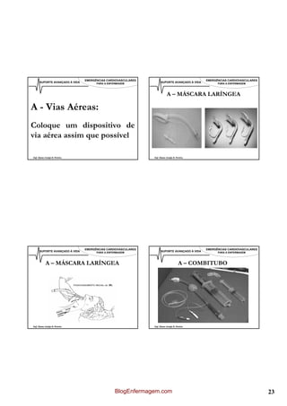 EMERGÊNCIAS CARDIOVASCULARES                                   EMERGÊNCIAS CARDIOVASCULARES
      SUPORTE AVANÇADO À VIDA         PARA A ENFERMAGEM              SUPORTE AVANÇADO À VIDA         PARA A ENFERMAGEM



                                                                           A – MÁSCARA LARÍNGEA

A - Vias Aéreas:
Coloque um dispositivo de
via aérea assim que possível

Enf. Álamo Araújo B. Pereira                                   Enf. Álamo Araújo B. Pereira




                                EMERGÊNCIAS CARDIOVASCULARES                                   EMERGÊNCIAS CARDIOVASCULARES
      SUPORTE AVANÇADO À VIDA         PARA A ENFERMAGEM              SUPORTE AVANÇADO À VIDA         PARA A ENFERMAGEM



            A – MÁSCARA LARÍNGEA                                                      A – COMBITUBO




Enf. Álamo Araújo B. Pereira                                   Enf. Álamo Araújo B. Pereira




                                                 BlogEnfermagem.com                                                           23
 