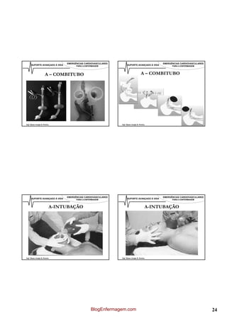 EMERGÊNCIAS CARDIOVASCULARES                                   EMERGÊNCIAS CARDIOVASCULARES
      SUPORTE AVANÇADO À VIDA         PARA A ENFERMAGEM              SUPORTE AVANÇADO À VIDA         PARA A ENFERMAGEM



                       A – COMBITUBO                                                  A – COMBITUBO




Enf. Álamo Araújo B. Pereira                                   Enf. Álamo Araújo B. Pereira




                                EMERGÊNCIAS CARDIOVASCULARES                                   EMERGÊNCIAS CARDIOVASCULARES
      SUPORTE AVANÇADO À VIDA         PARA A ENFERMAGEM              SUPORTE AVANÇADO À VIDA         PARA A ENFERMAGEM



                           A-INTUBAÇÃO                                                    A-INTUBAÇÃO




Enf. Álamo Araújo B. Pereira                                   Enf. Álamo Araújo B. Pereira




                                                 BlogEnfermagem.com                                                           24
 