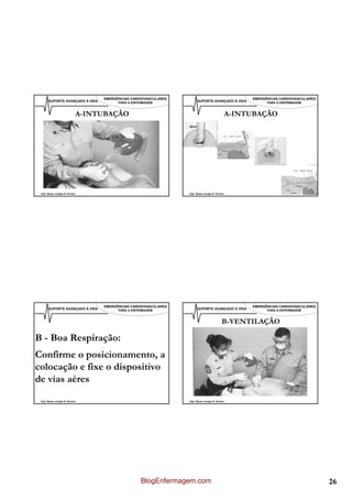 EMERGÊNCIAS CARDIOVASCULARES                                   EMERGÊNCIAS CARDIOVASCULARES
       SUPORTE AVANÇADO À VIDA         PARA A ENFERMAGEM              SUPORTE AVANÇADO À VIDA         PARA A ENFERMAGEM



                            A-INTUBAÇÃO                                                    A-INTUBAÇÃO




 Enf. Álamo Araújo B. Pereira                                   Enf. Álamo Araújo B. Pereira




                                 EMERGÊNCIAS CARDIOVASCULARES                                   EMERGÊNCIAS CARDIOVASCULARES
       SUPORTE AVANÇADO À VIDA         PARA A ENFERMAGEM              SUPORTE AVANÇADO À VIDA         PARA A ENFERMAGEM



                                                                                          B-VENTILAÇÃO

B - Boa Respiração:
Confirme o posicionamento, a
colocação e fixe o dispositivo
de vias aéres

 Enf. Álamo Araújo B. Pereira                                   Enf. Álamo Araújo B. Pereira




                                                  BlogEnfermagem.com                                                           26
 
