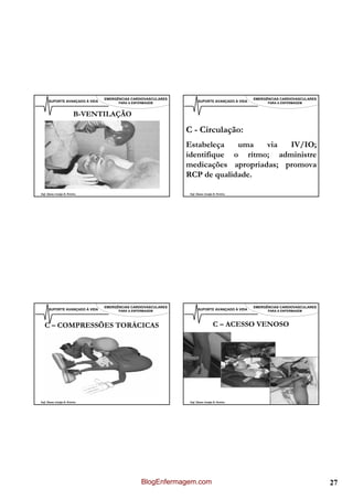 EMERGÊNCIAS CARDIOVASCULARES                                    EMERGÊNCIAS CARDIOVASCULARES
      SUPORTE AVANÇADO À VIDA         PARA A ENFERMAGEM               SUPORTE AVANÇADO À VIDA         PARA A ENFERMAGEM



                          B-VENTILAÇÃO

                                                               C - Circulação:
                                                               Estabeleça   uma    via  IV/IO;
                                                               identifique o rítmo; administre
                                                               medicações apropriadas; promova
                                                               RCP de qualidade.

Enf. Álamo Araújo B. Pereira                                    Enf. Álamo Araújo B. Pereira




                                EMERGÊNCIAS CARDIOVASCULARES                                    EMERGÊNCIAS CARDIOVASCULARES
      SUPORTE AVANÇADO À VIDA         PARA A ENFERMAGEM               SUPORTE AVANÇADO À VIDA         PARA A ENFERMAGEM




   C – COMPRESSÕES TORÁCICAS                                                      C – ACESSO VENOSO




Enf. Álamo Araújo B. Pereira                                    Enf. Álamo Araújo B. Pereira




                                                 BlogEnfermagem.com                                                            27
 