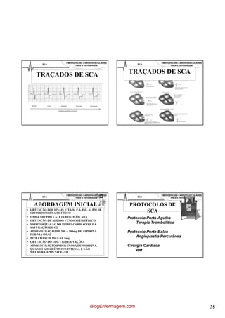 EMERGÊNCIAS CARDIOVASCULARES                       EMERGÊNCIAS CARDIOVASCULARES
         SCA                  PARA A ENFERMAGEM               SCA                PARA A ENFERMAGEM




     TRAÇADOS DE SCA                                    TRAÇADOS DE SCA




                        EMERGÊNCIAS CARDIOVASCULARES                       EMERGÊNCIAS CARDIOVASCULARES
         SCA                  PARA A ENFERMAGEM               SCA                PARA A ENFERMAGEM



    ABORDAGEM INICIAL                                   PROTOCOLOS DE
• OBTENÇÃO DOS SINAIS VITAIS: P.A, F.C, ALÉM DE
  CRITERIOSO EXAME FÍSICO                                    SCA
• OXIGÊNIO POR CATETER OU MÁSCARA                      Protocolo Porta-Agulha
• OBTENÇÃO DE ACESSO VENOSO PERIFÉRICO
• MONITORIZAÇÃO DO RITMO CARDÍACO E DA
                                                           Terapia Trombolítica
  SATURAÇÃO DE O2
• ADMINISTRAÇÃO DE 200 A 500mg DE ASPIRINA             Protocolo Porta-Balão
  POR VIA ORAL
• NITRATO SUBLINGUAL 5mg
                                                           Angioplastia Percutânea
• OBTENÇÃO DO ECG – 12 DERIVAÇÕES
• ADMINISTRAÇÃO ENDOVENOSA DE MORFINA,                 Cirurgia Cardíaca
  QUANDO A DOR É MUITO INTENSA E NÃO
  MELHORA APÓS NITRATO
                                                            RM




                                         BlogEnfermagem.com                                               35
 