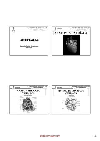 EMERGÊNCIAS CARDIOVASCULARES                   EMERGÊNCIAS CARDIOVASCULARES
                                  PARA A ENFERMAGEM         ARRITIMIAS         PARA A ENFERMAGEM




                                                         ANATOMIA CARDÍACA

             ARRITMIAS
             Patrícia Freire Cavalcante
                     ENFERMEIRA




                          EMERGÊNCIAS CARDIOVASCULARES                   EMERGÊNCIAS CARDIOVASCULARES
ARRITIMIAS                        PARA A ENFERMAGEM         ARRITIMIAS         PARA A ENFERMAGEM


    ANATOFISIOLOGIA                                          SISTEMA DE CONDUÇÃO
       CARDÍACA                                                    CARDÍACA




                                             BlogEnfermagem.com                                         5
 