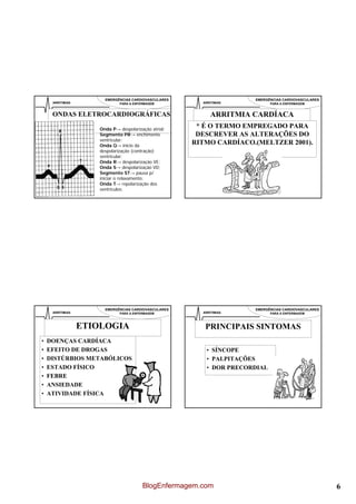 EMERGÊNCIAS CARDIOVASCULARES                   EMERGÊNCIAS CARDIOVASCULARES
     ARRITIMIAS                PARA A ENFERMAGEM         ARRITIMIAS           PARA A ENFERMAGEM


     ONDAS ELETROCARDIOGRÁFICAS                              ARRITMIA CARDÍACA
                      Onda P→ despolarização atrial;
                                                        * É O TERMO EMPREGADO PARA
                      Segmento PR→ enchimento           DESCREVER AS ALTERAÇÕES DO
                      ventricular;
                      Onda Q→ início da
                                                       RITMO CARDÍACO.(MELTZER 2001).
                      despolarização (contração)
                      ventricular;
                      Onda R→ despolarização VE;
                      Onda S→ despolarização VD;
                      Segmento ST→ pausa p/
                      iniciar o relaxamento;
                      Onda T→ repolarização dos
                      ventrículos;




                        EMERGÊNCIAS CARDIOVASCULARES                   EMERGÊNCIAS CARDIOVASCULARES
     ARRITIMIAS                PARA A ENFERMAGEM         ARRITIMIAS           PARA A ENFERMAGEM



                  ETIOLOGIA                               PRINCIPAIS SINTOMAS
•   DOENÇAS CARDÍACA
•   EFEITO DE DROGAS                                       • SÍNCOPE
•   DISTÚRBIOS METABÓLICOS                                 • PALPITAÇÕES
•   ESTADO FÍSICO                                          • DOR PRECORDIAL
•   FEBRE
•   ANSIEDADE
•   ATIVIDADE FÍSICA




                                          BlogEnfermagem.com                                          6
 