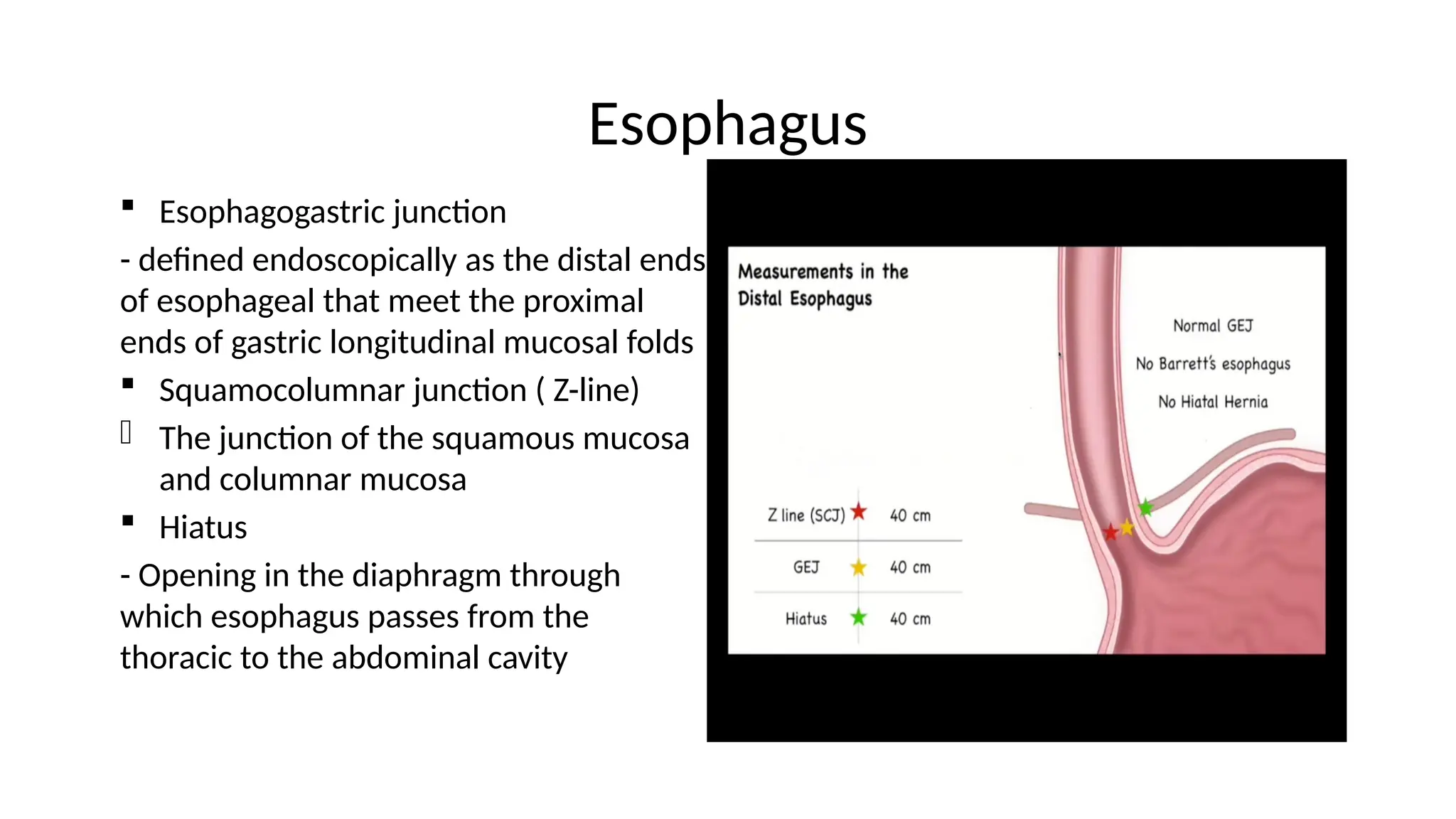 Esophagus
 Esophagogastric junction
- defined endoscopically as the distal ends
of esophageal that meet the proximal
ends of gastric longitudinal mucosal folds
 Squamocolumnar junction ( Z-line)
- The junction of the squamous mucosa
and columnar mucosa
 Hiatus
- Opening in the diaphragm through
which esophagus passes from the
thoracic to the abdominal cavity
 