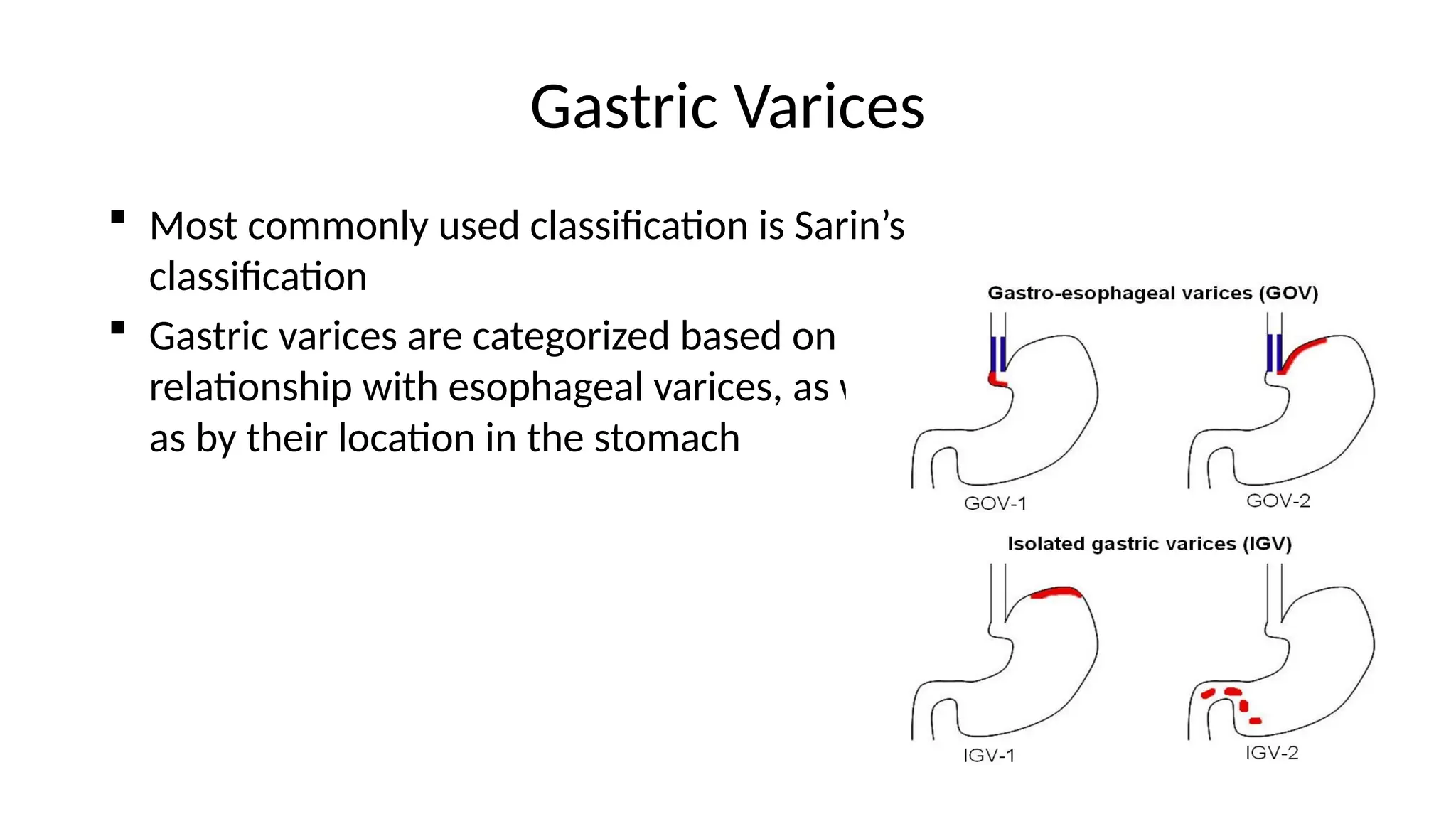 Gastric Varices
 Most commonly used classification is Sarin’s
classification
 Gastric varices are categorized based on the
relationship with esophageal varices, as well
as by their location in the stomach
 