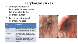 Jsph Varices Classification 5 endoscopy (2).pptxppt on edoscopy techniques | PPTX