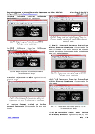 Enhancement of Medical Images using Histogram Based Hybrid Technique | PDF