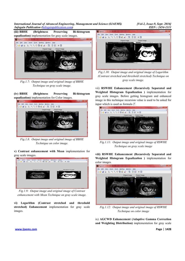 Enhancement of Medical Images using Histogram Based Hybrid Technique | PDF