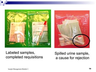 Sample Management-Module 5 19
Spilled urine sample,
a cause for rejection
Labeled samples,
completed requisitions
 