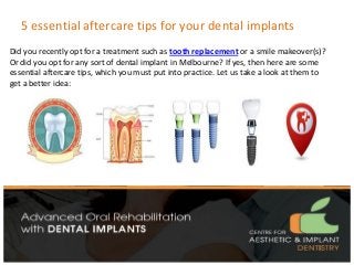 5 essential aftercare tips for your dental implants
Did you recently opt for a treatment such as tooth replacement or a smile makeover(s)?
Or did you opt for any sort of dental implant in Melbourne? If yes, then here are some
essential aftercare tips, which you must put into practice. Let us take a look at them to
get a better idea:
 