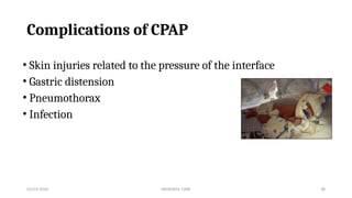 5 Essential care, CPAP,O2,Radiant warmer | PPTX