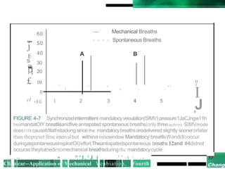 -
j
E
s
CD
-
60
50
40
30
.D
,l 20
£ 10
0
I'
'-
cl -10 1
A
--- Mechanical Breaths
- - - - Spontaneous Breaths
B
"
2
' , ,,
I
' I I
I
,
2 3 4 5
J
0
FIGURE 4-7 Synchronizedintermittent mandatocyveoulation(SIMV) pressure1JaCJngw11h
twomandatOIY breatllsandfive anriapated spontaneous breaths(only threeactive). SIMVmode
does110tcauseb!llathstacking since the mandatocybreathsaredelivered slightly soonerorlater
than thepreset llmeintervalbut withina timewindow.Mandatocy breatllsWand(B)occur
duringaspontaneousinsplra!OI)'effort.Theantiapatedspontaneous breaths12and #4didnot
occurastheyturnedintomechanical breathsduring the mandatocycycle.
,,,...,-- • " ' l . ' J i ' ' 'l '· •
Cli_nicar--Application-of·Mechanical Venbiation, Fourth I •
 