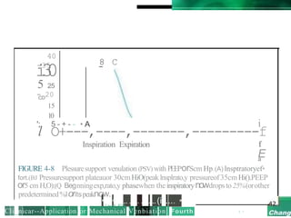 40
i
-3
3
5
0
5 25
-
CD
20
15
10
';. 5 - + - - • A i
l O+---,----,-------,---------f
Inspiration Expiration f
E
a
FIGURE 4-8 Plessuresupport venulation (PSV) with PEEPorScm Hp.(A) lnsptratoryef•
fort.(BJ Pressuresupport plateauor 30cmHiO(peaklnsplrato,y pressureof35cm Hi().PEEP
or5 cm H,O);(Q Begnningexp,rato,y phasewhen theinspiratorynowdropsto25%(orother
predetermined%loritspeaknow.
8 C
- ' > r l f'9.
Cli_nicar--Application·or·Mechanical Venbiation, Fourth
• • ... .. ...(i'i.... •
I •
 