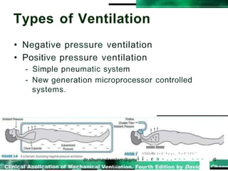 Types of Ventilation
• Negative pressure ventilation
• Positive pressure ventilation
- Simple pneumatic system
- New generation microprocessor controlled
systems.
--
AGUti 7 AXh!mlile J r 8 ' 9 o a s . . N e P ' l 5 U "
i i . e a - . . - - - - - -
 