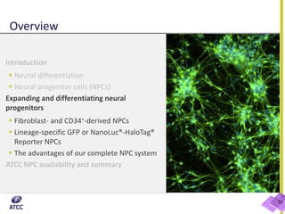 Overview
Introduction
 Neural differentiation
 Neural progenitor cells (NPCs)
Expanding and differentiating neural
progenitors
 Fibroblast- and CD34+-derived NPCs
 Lineage-specific GFP or NanoLuc®-HaloTag®
Reporter NPCs
 The advantages of our complete NPC system
ATCC NPC availability and summary
12
 