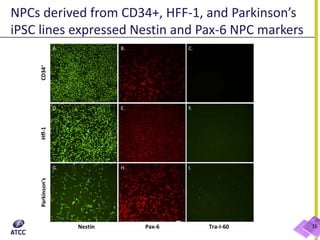 NPCs derived from CD34+, HFF-1, and Parkinson’s
iPSC lines expressed Nestin and Pax-6 NPC markers
15
 